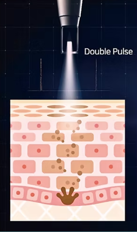 Double Pulse